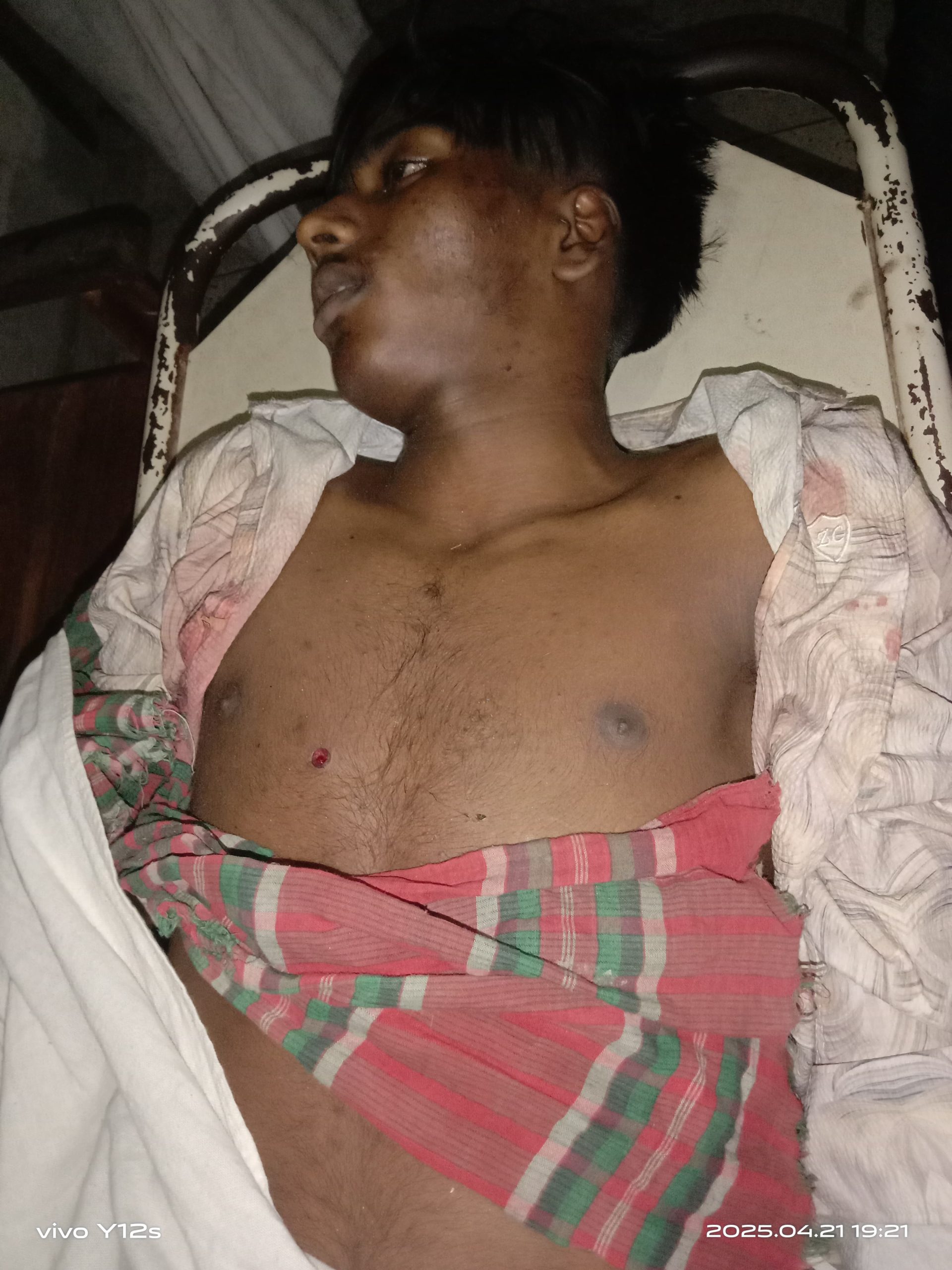 বরিশালে র‌্যাবের ওপর হামলা পাল্টাগুলিতে মাদক ব্যবসায়ী নিহত