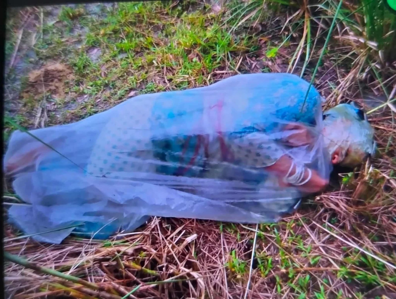 বরিশালে মহাসড়কের পাশে পলিথিনে মোড়ানো এসিডদগ্ধ নারী, জীবিত উদ্ধার করল পুলিশ